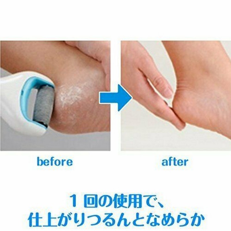 Electronic Foot File Foot Razor with Marine Minerals NY Store