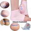 Silicone Gel Heel Socks For Dry Hard Cracked Heels Foot Repair, Foot Care Compression Cushion With Gel Pad For Men And Women [Free Size]